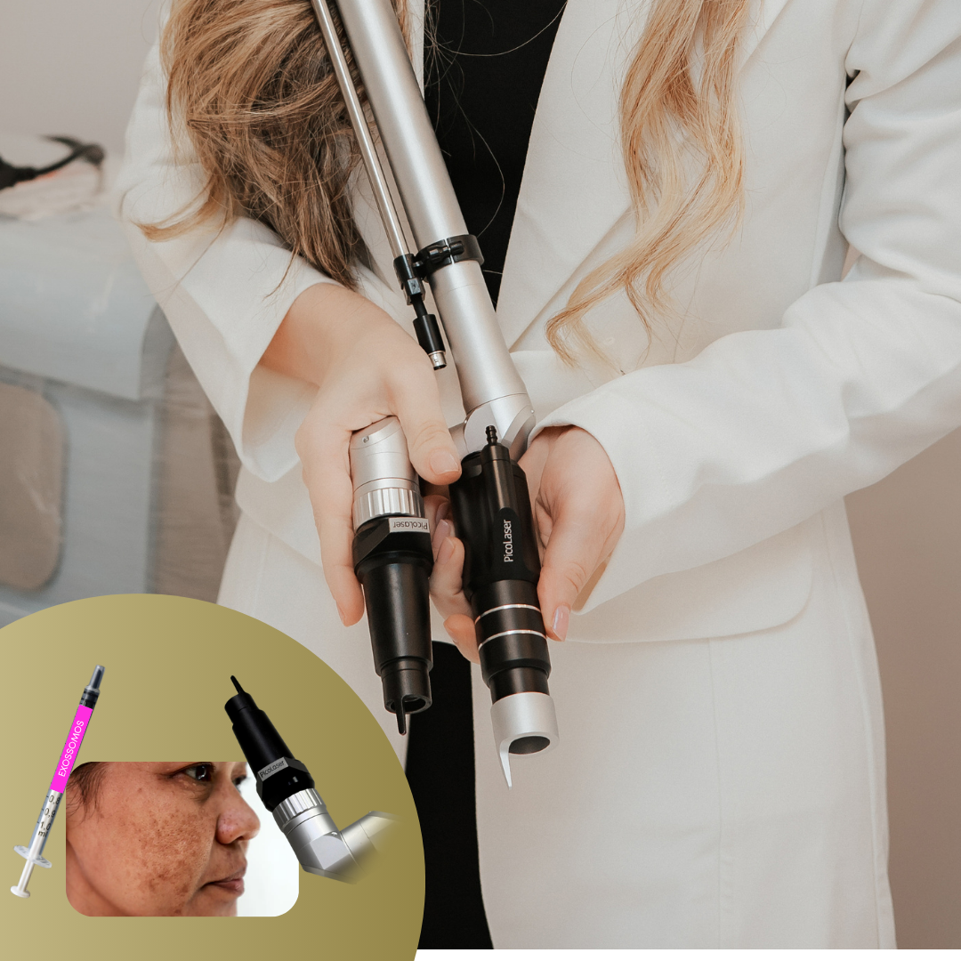 Laser Picossegundos para Melasma