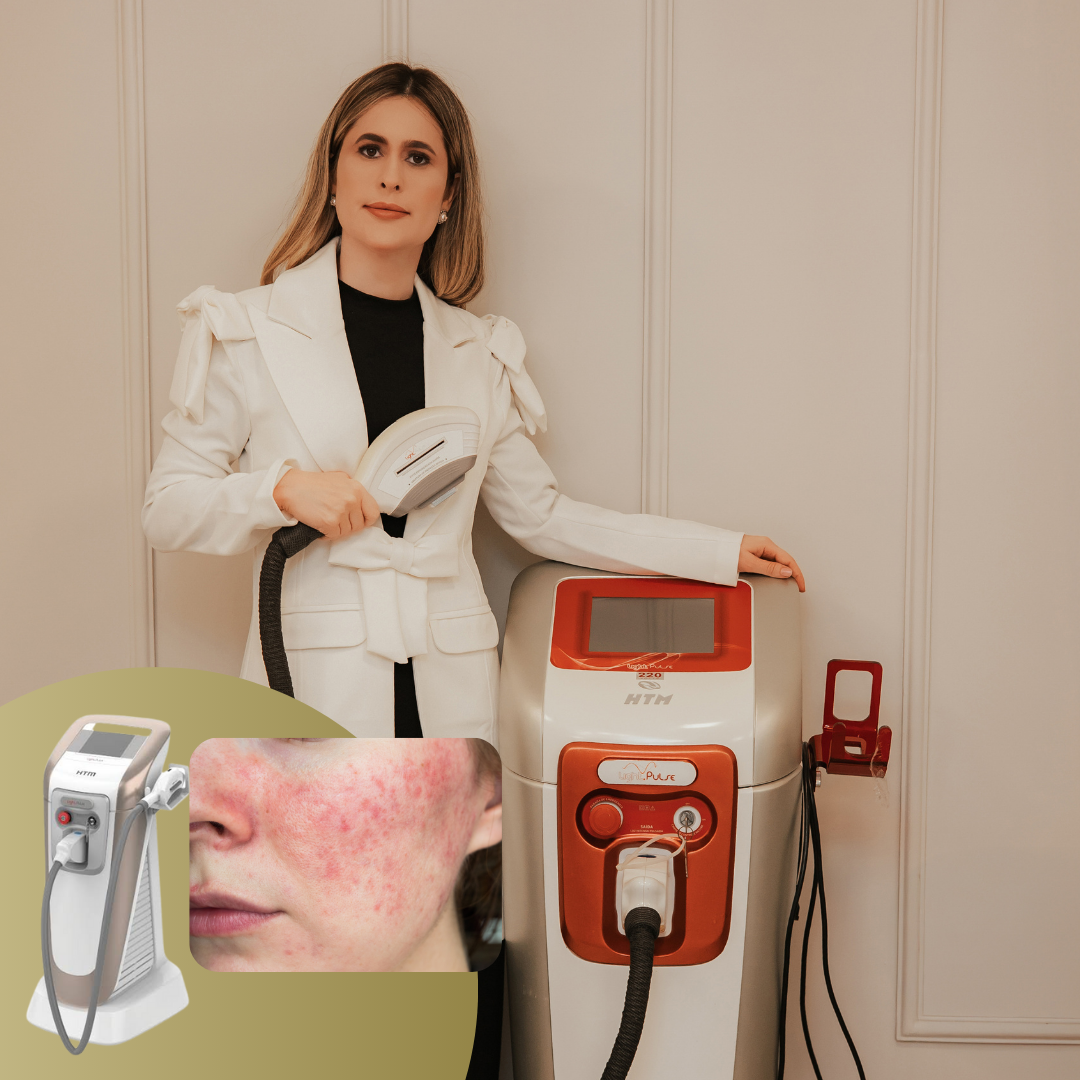 Limpeza de Pele Tratamento Rosácea