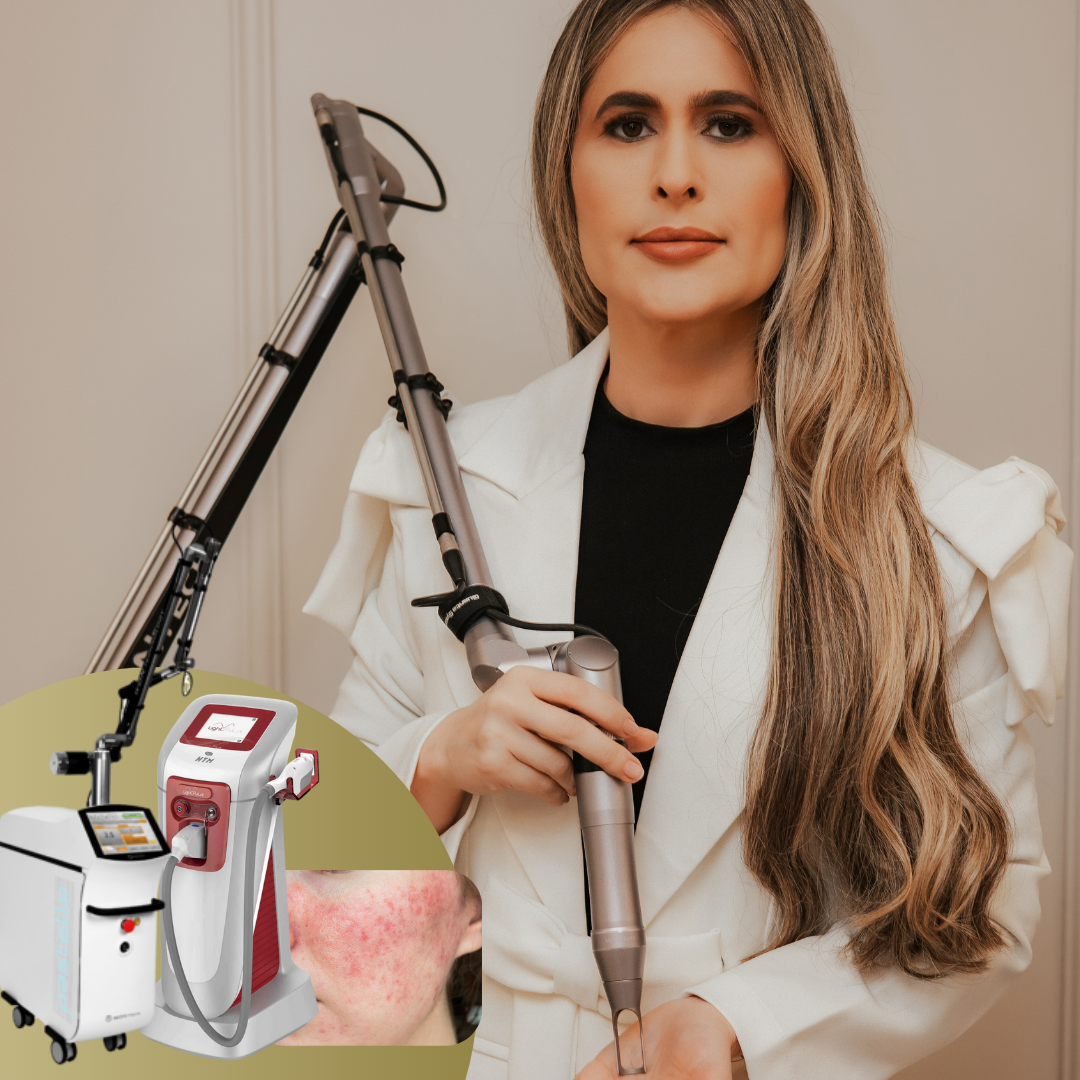 LASER PASTELLE + Luz pulsada para tratamento de rosácea