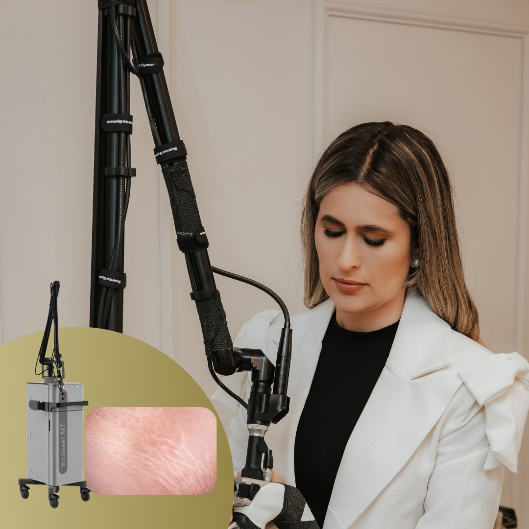 YOULASER CO2 para tratamento de estrias