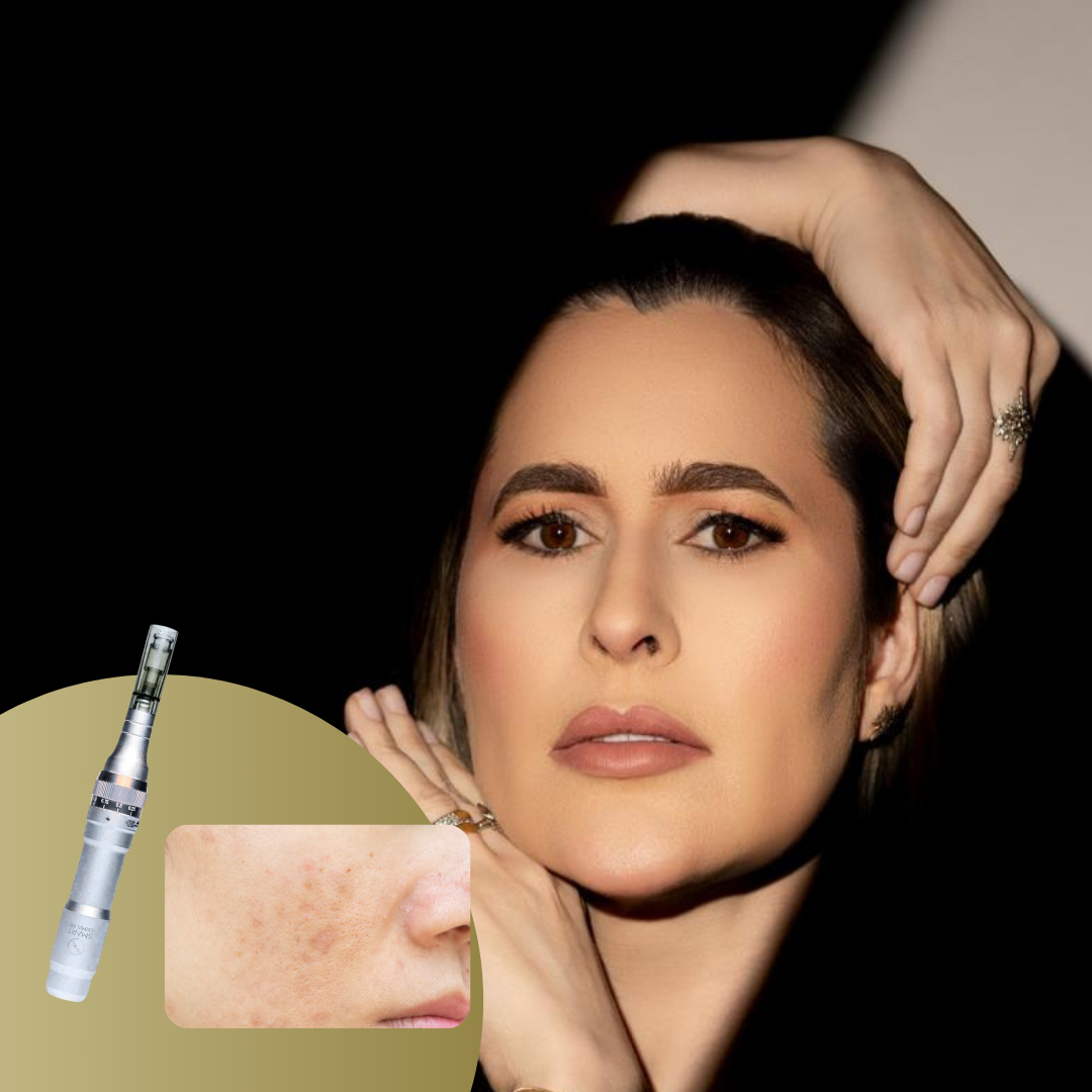 Limpeza de pele para manchas - Com dermapen + ácido tranexâmico, que inibe a síntese de melanina.