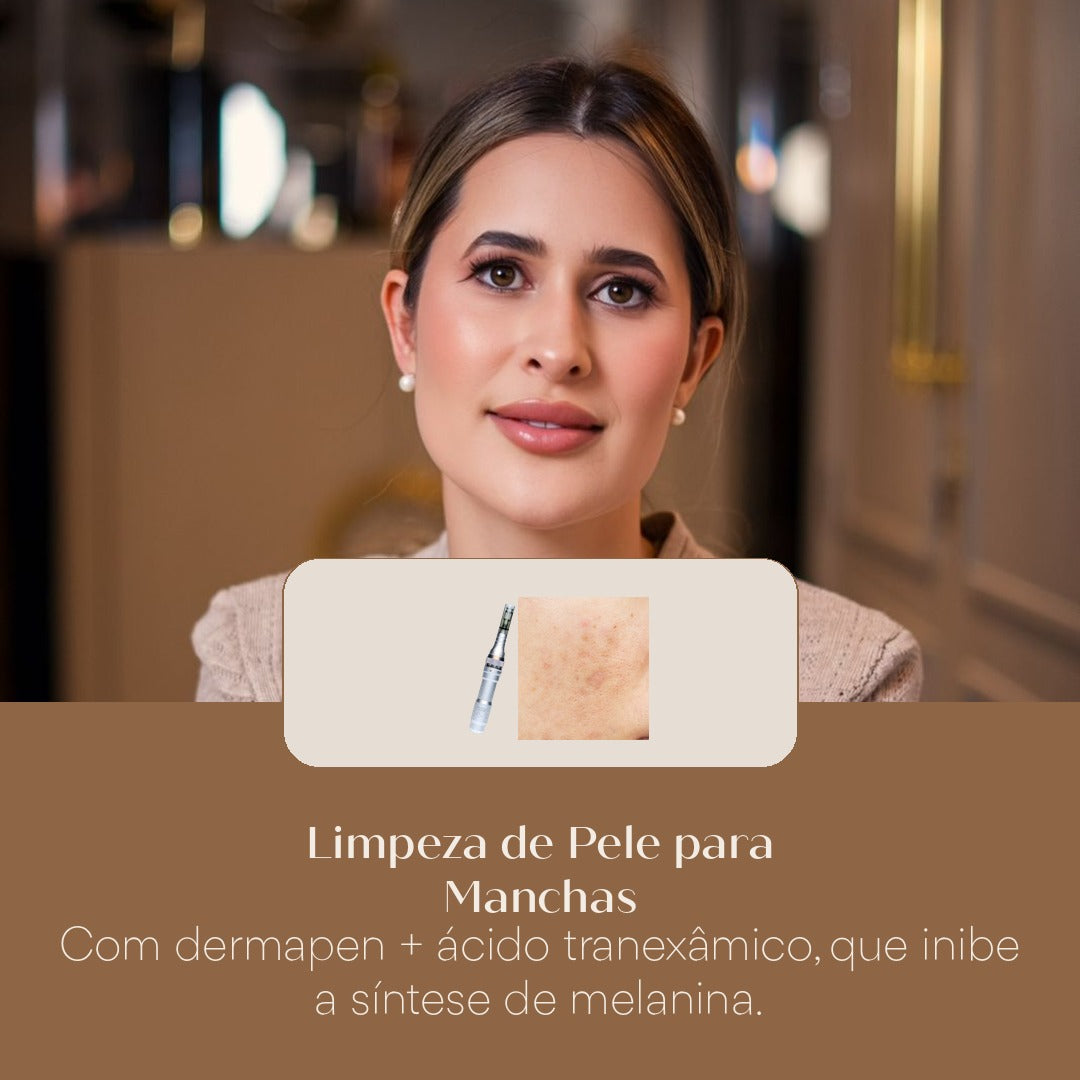 Limpeza de Pele para Manchas Com dermapen + ácido tranexâmico, que inibe a síntese de melanina.