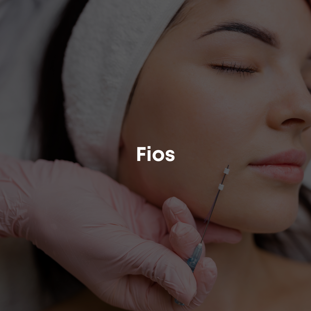 Fios