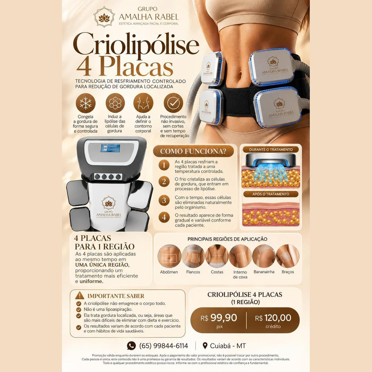 Criolipólise 4 Placas (1 região)