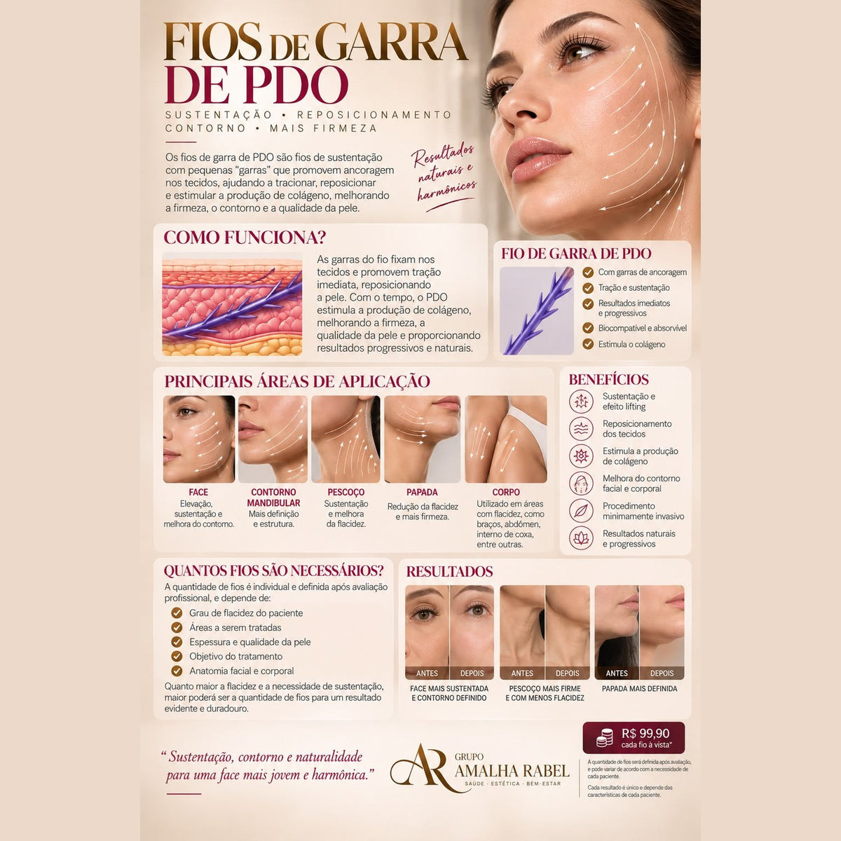 Fios de Garra de PDO - Sustentação • Reposicionamento • Contorno • Mais firmeza
