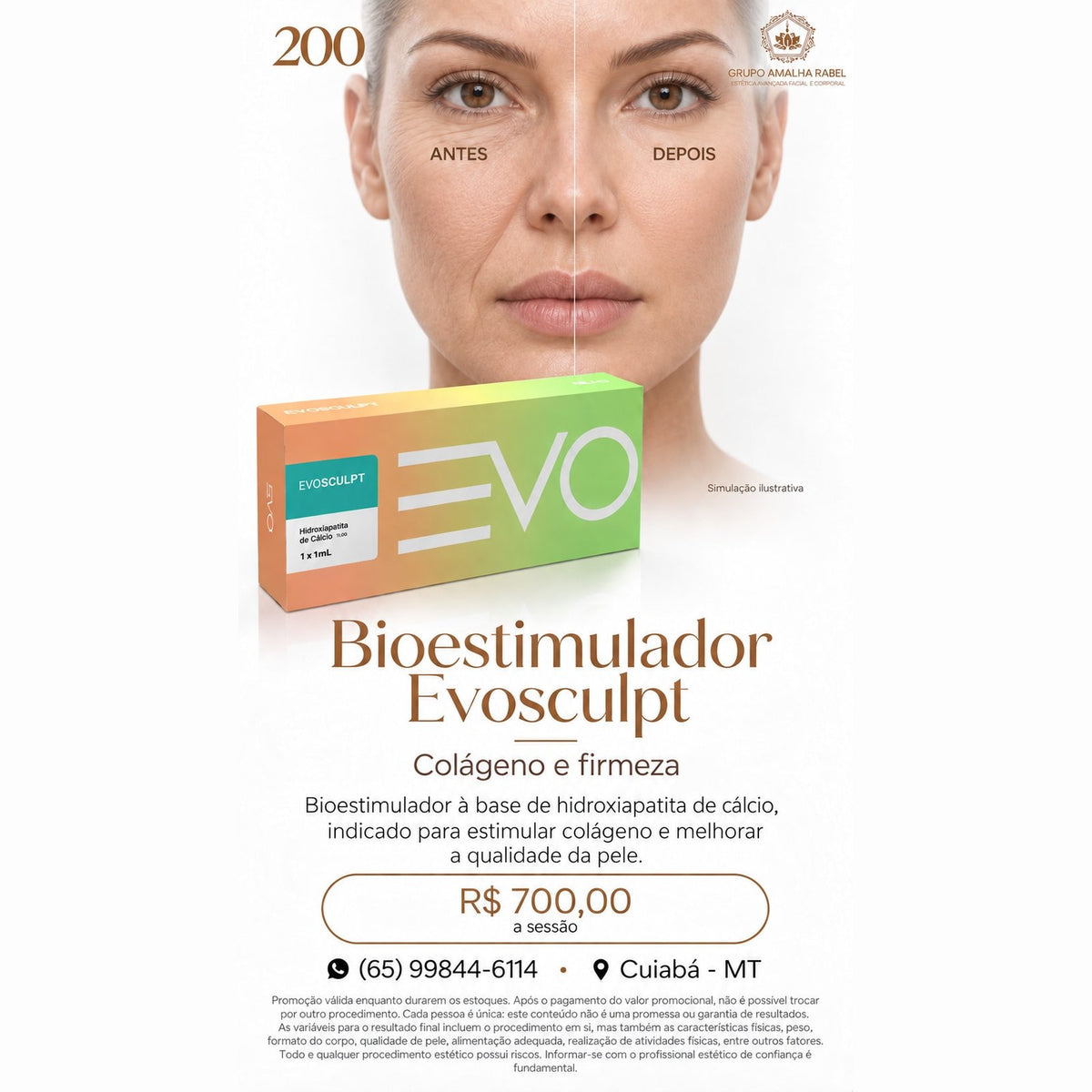 Bioestimulador Evosculpt - Colágeno e firmeza
