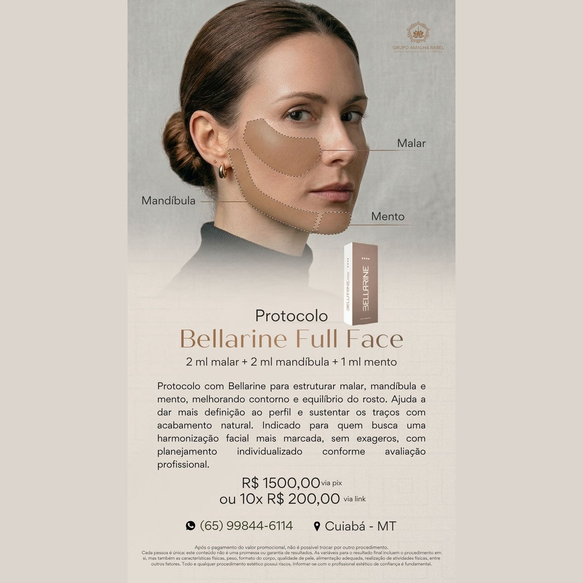 Protocolo Bellarine Full Face - 2 ml malar + 2 ml mandíbula + 1 ml mento