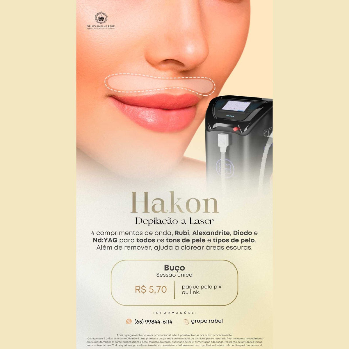 Hakon - Depilação a Laser - Buço (Sessão única)