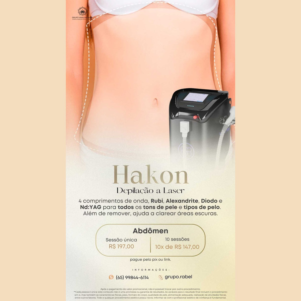 Hakon - Depilação a Laser - Abdômen (10 sessões)