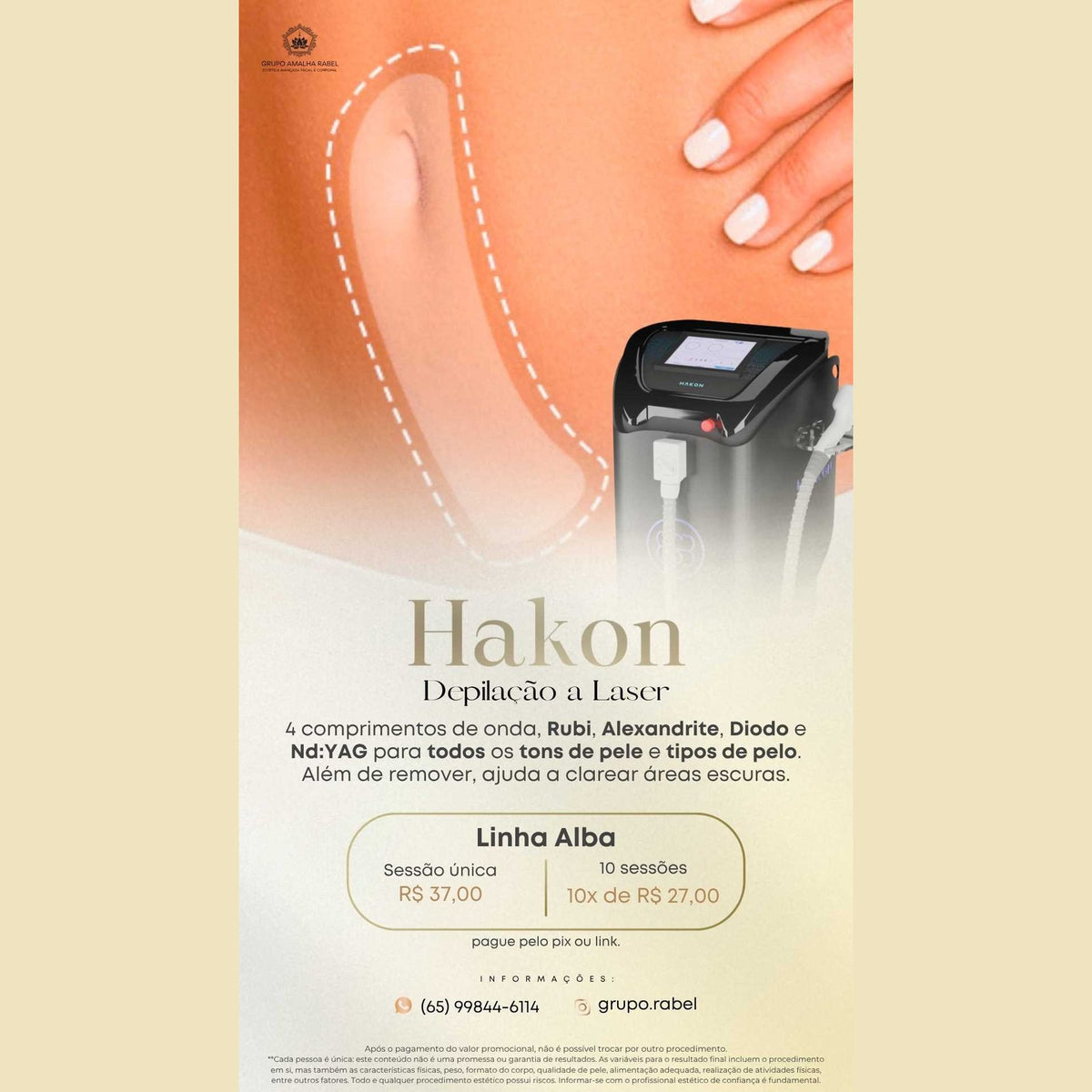 Hakon - Depilação a Laser - Linha Alba (Sessão única)