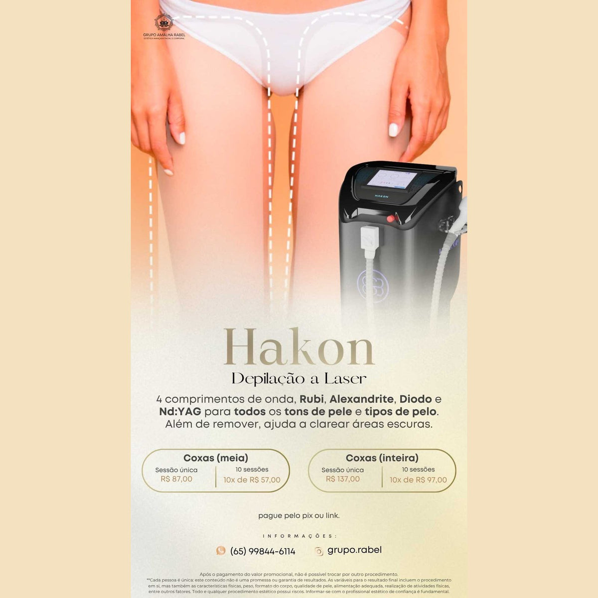 Hakon - Depilação a Laser - Coxas (inteira) (10 sessões)