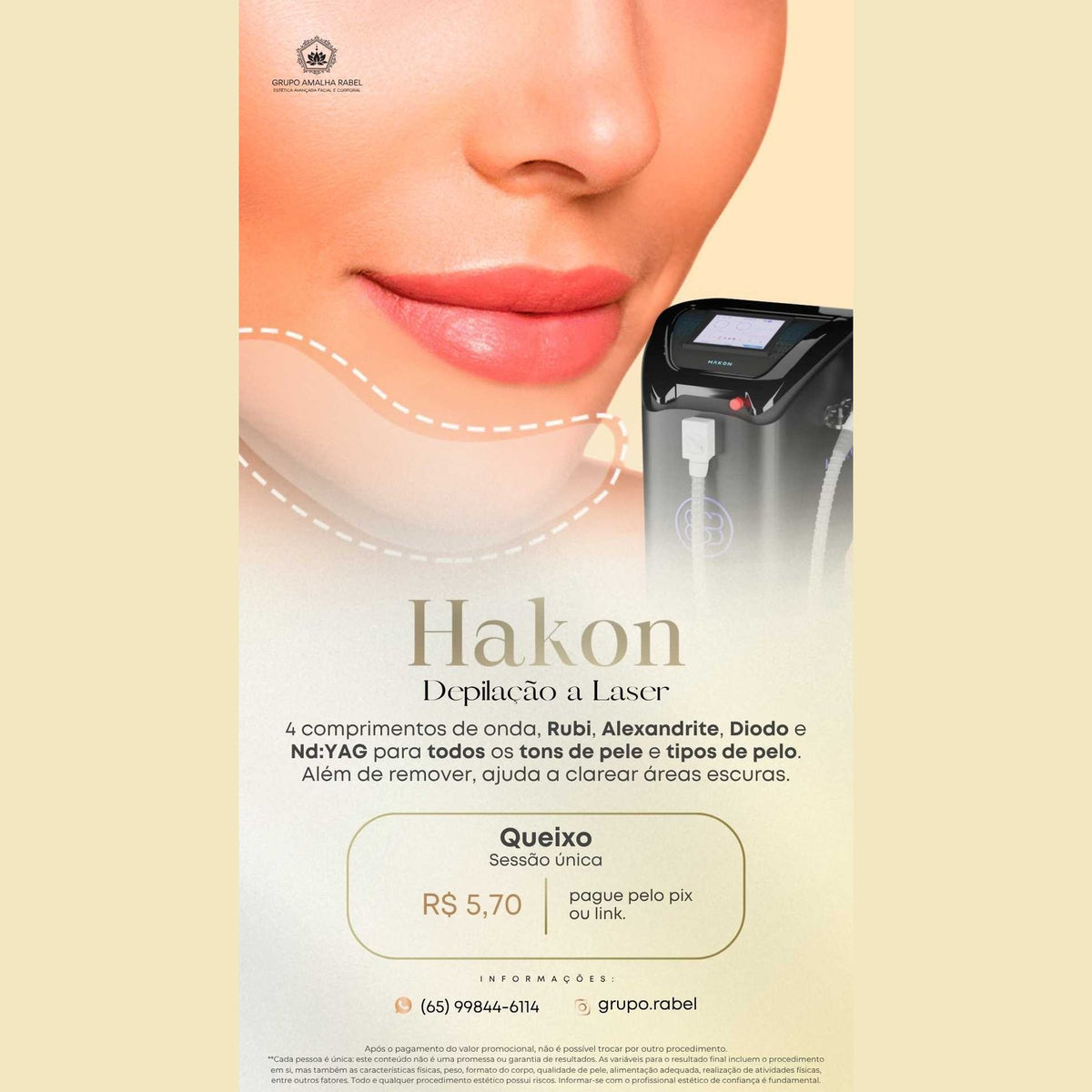 Hakon - Depilação a Laser - Queixo (Sessão única)