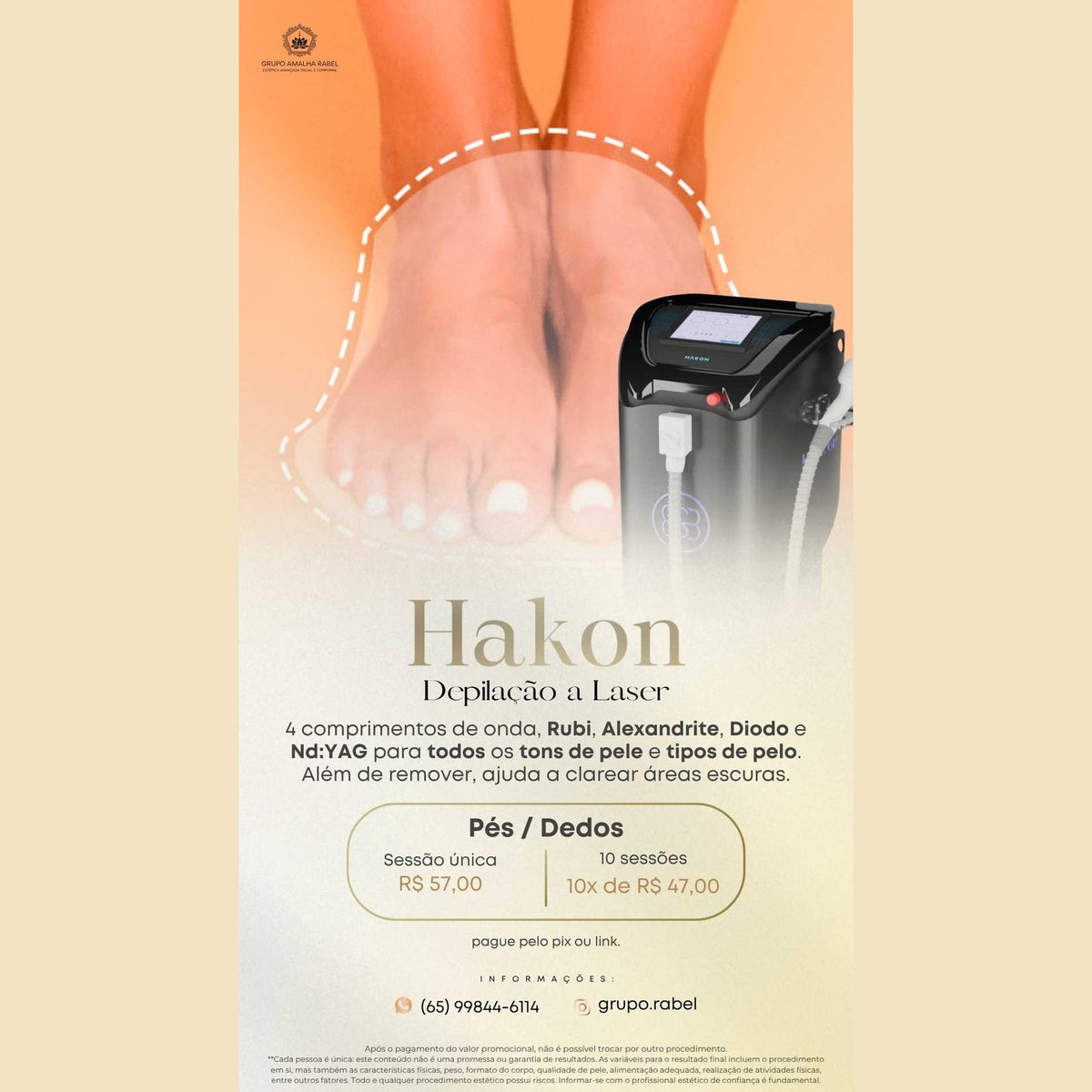 Hakon - Depilação a Laser - Pés / Dedos (10 sessões)