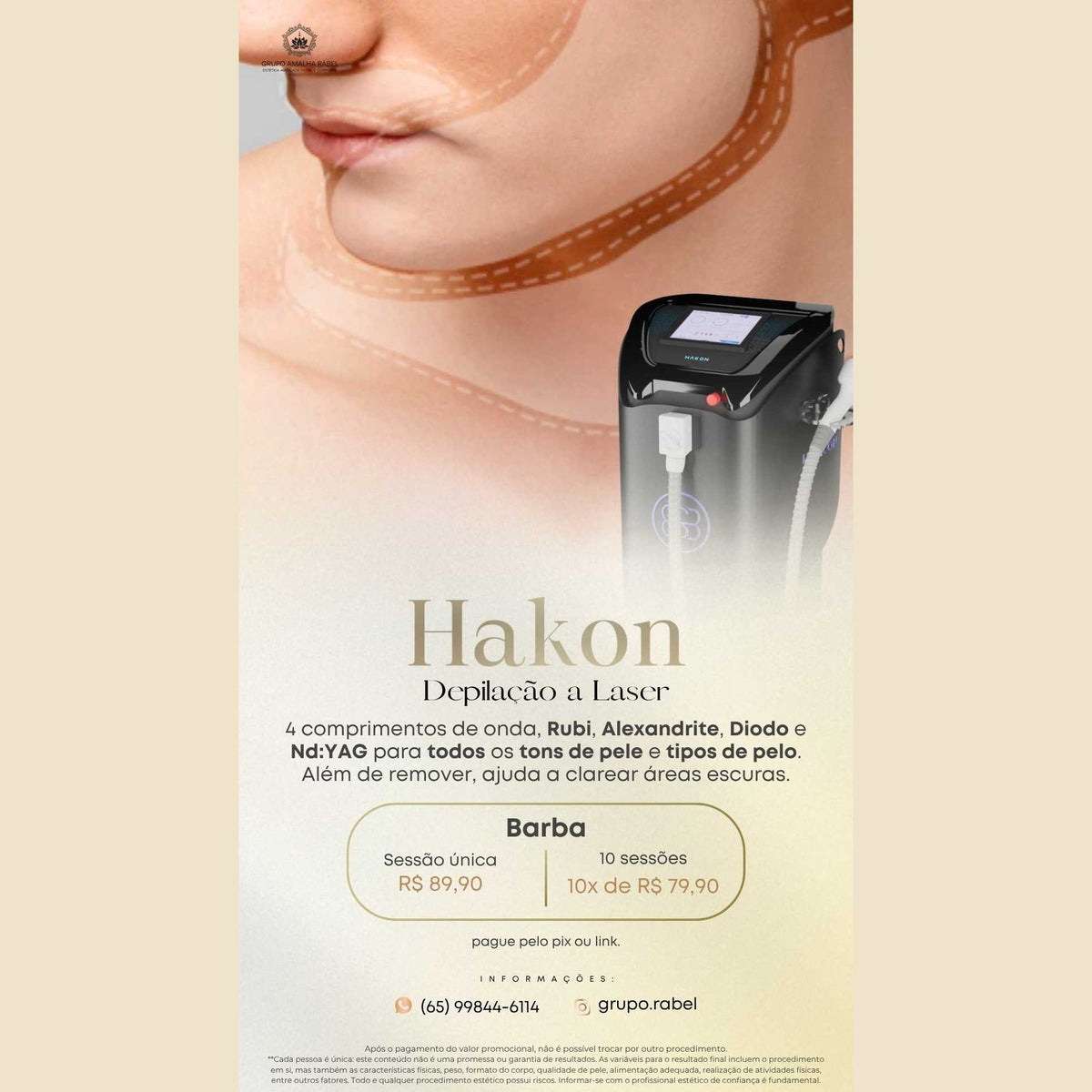 Hakon - Depilação a Laser - Barba (Sessão única)