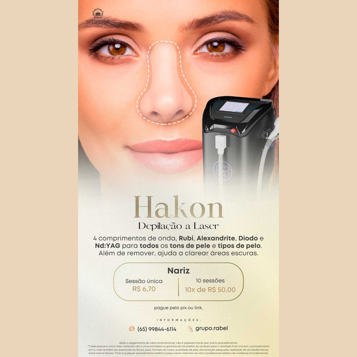 Hakon - Depilação a Laser - Nariz (Sessão única)