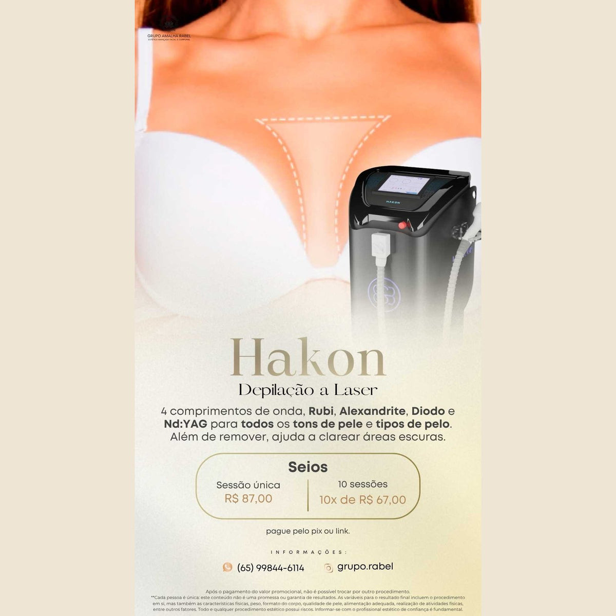 Hakon - Depilação a Laser - Seios (Sessão única)