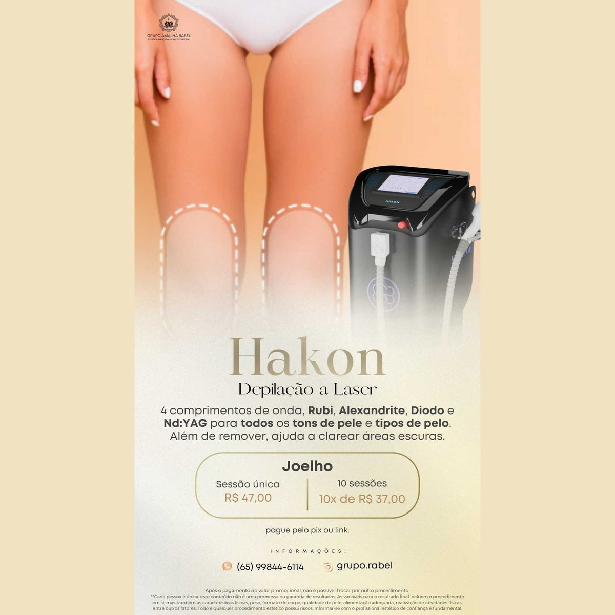 Hakon - Depilação a Laser - Joelho (10 sessões)