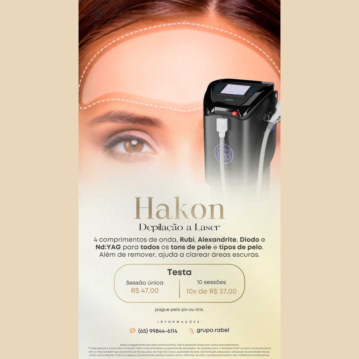Hakon - Depilação a Laser - Testa (Sessão única)