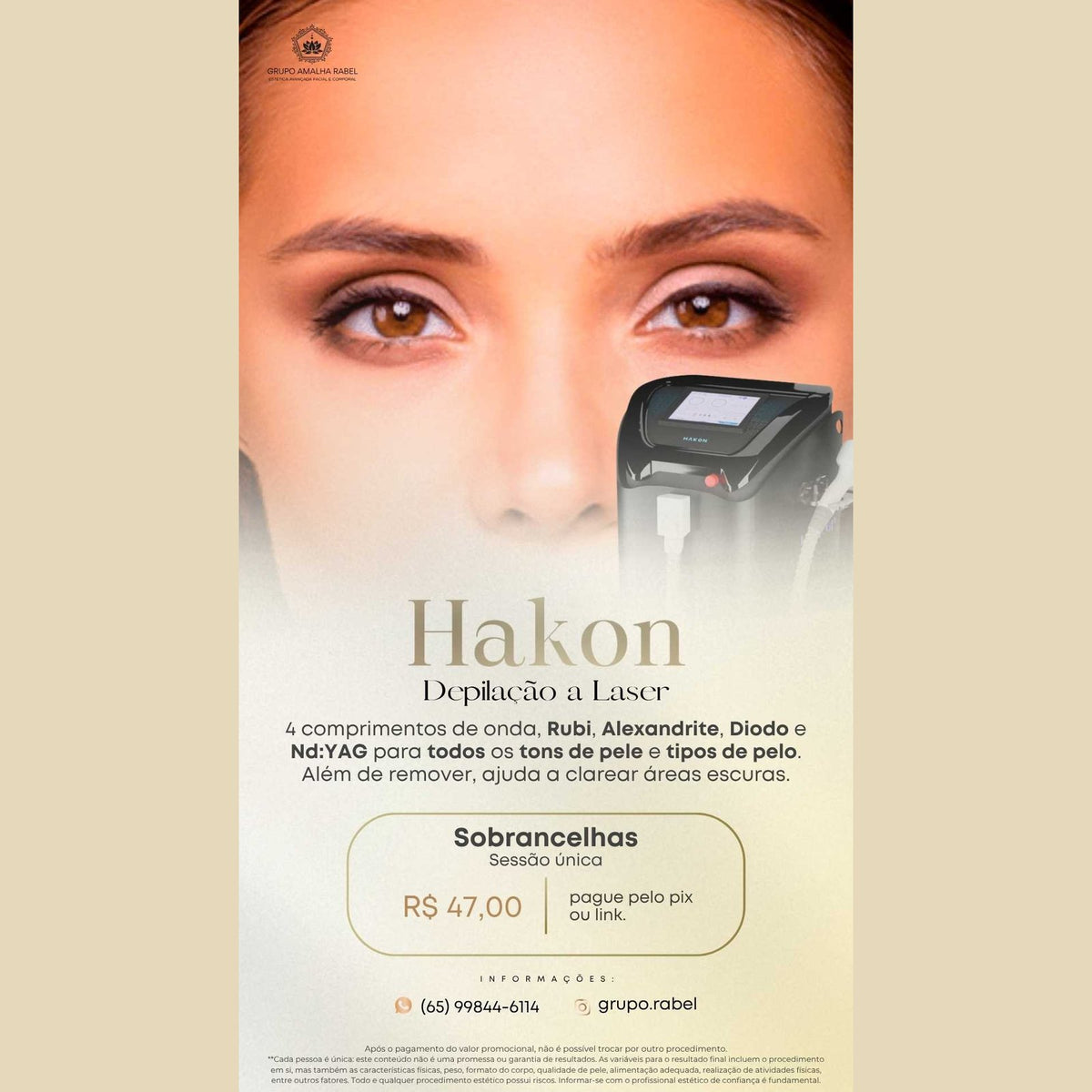 Hakon - Depilação a Laser - Sobrancelhas (Sessão única)