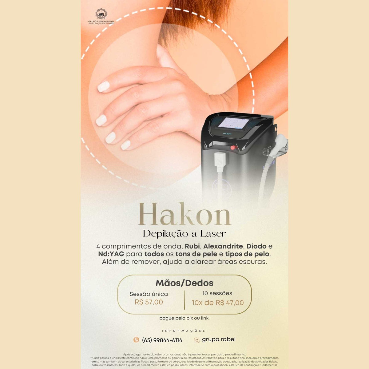 Hakon - Depilação a Laser - Mãos/Dedos (10 sessões)