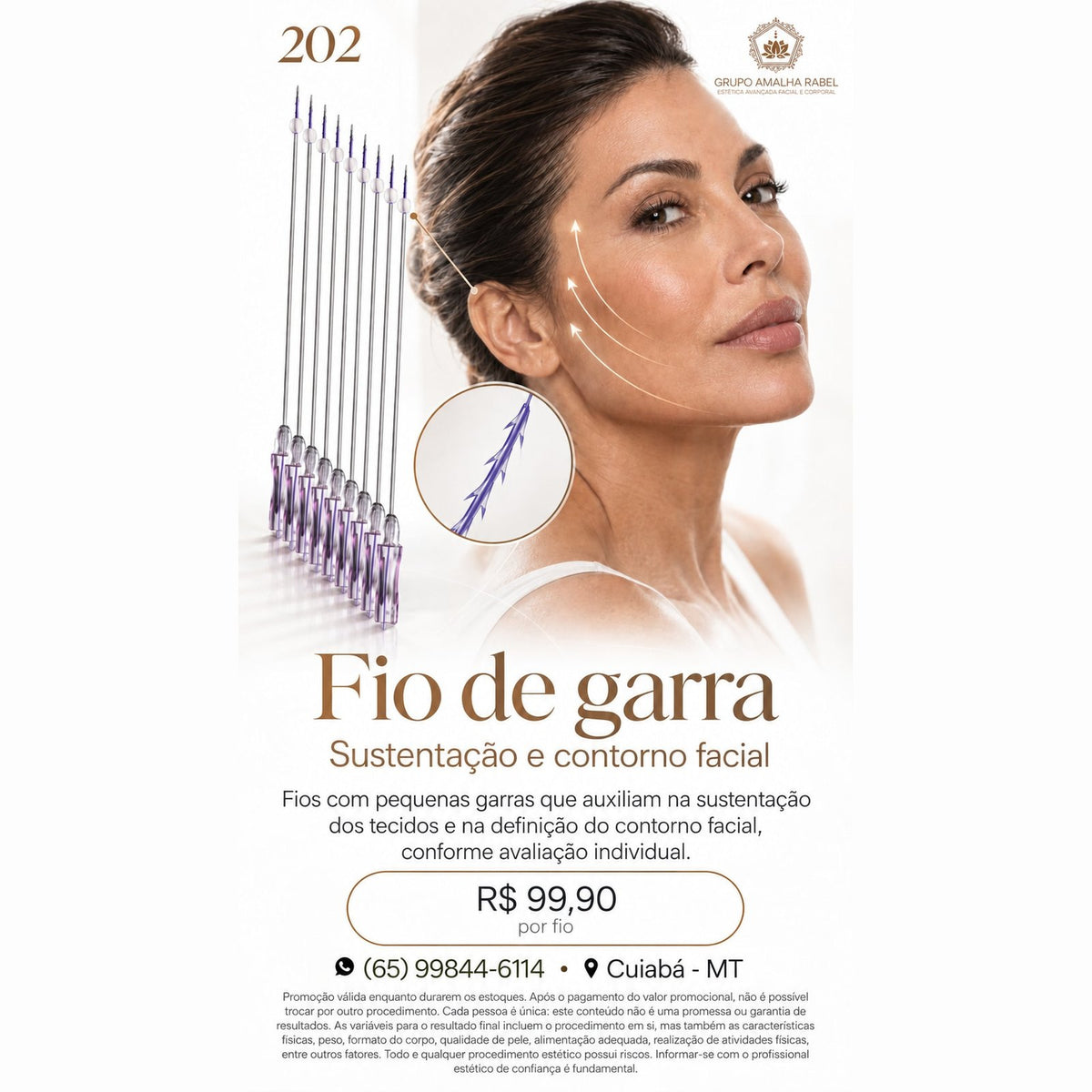 Fio de garra - Sustentação e contorno facial