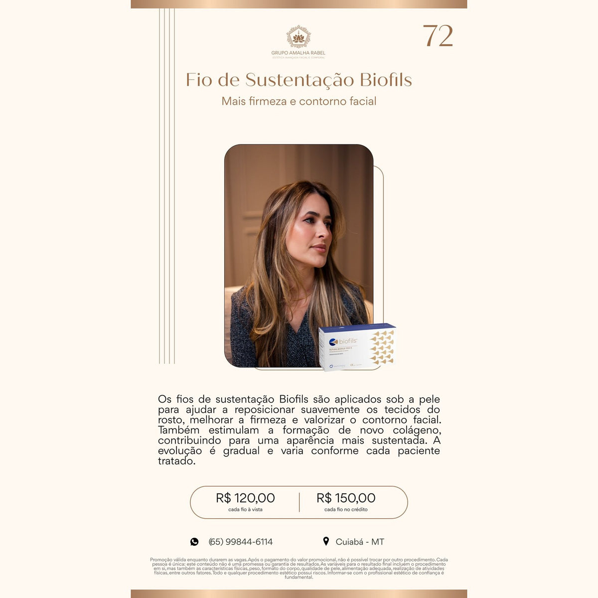 Fio de Sustentação Biofils - Mais firmeza e contorno facial