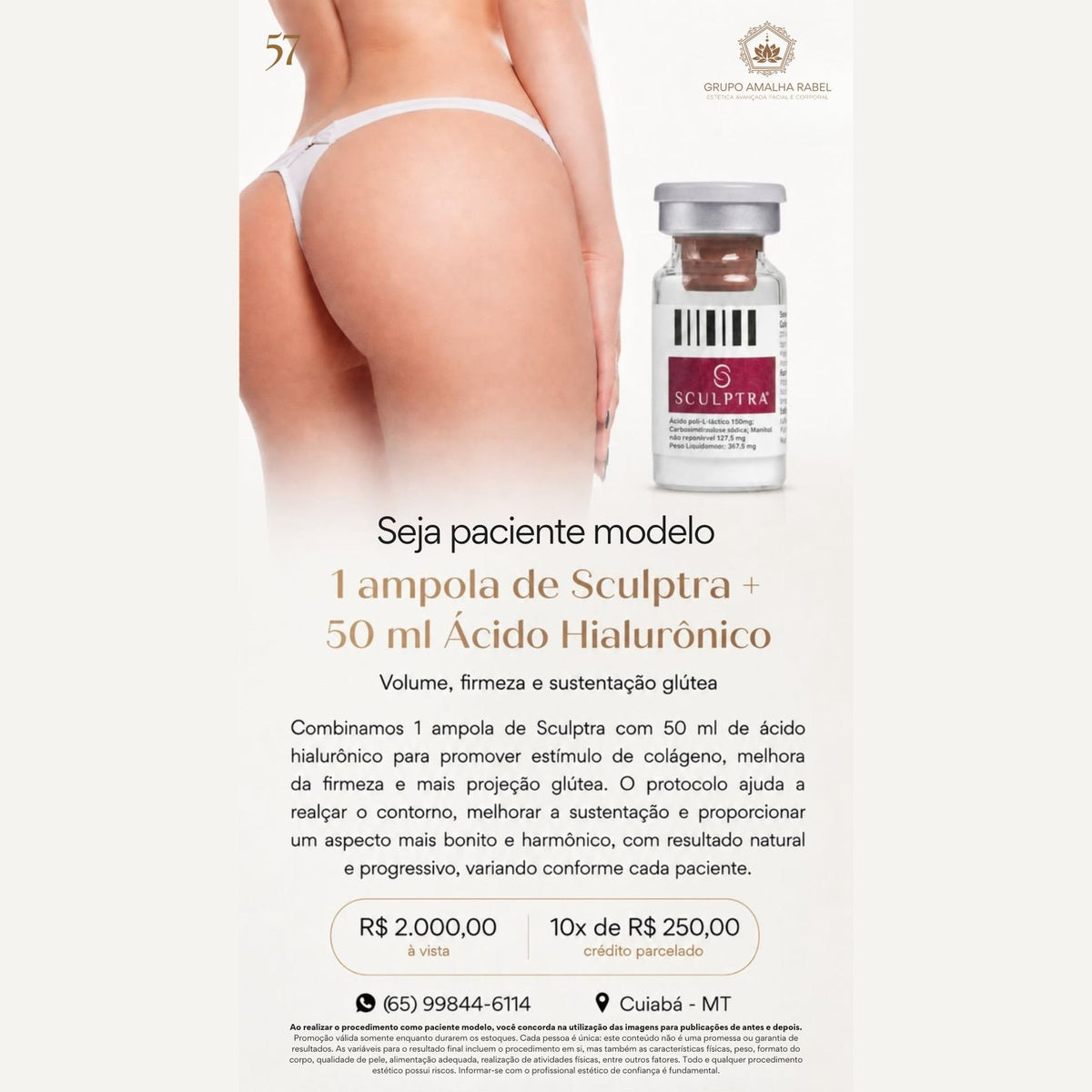1 ampola de Sculptra + 50 ml Ácido Hialurônico - Volume, firmeza e sustentação glútea