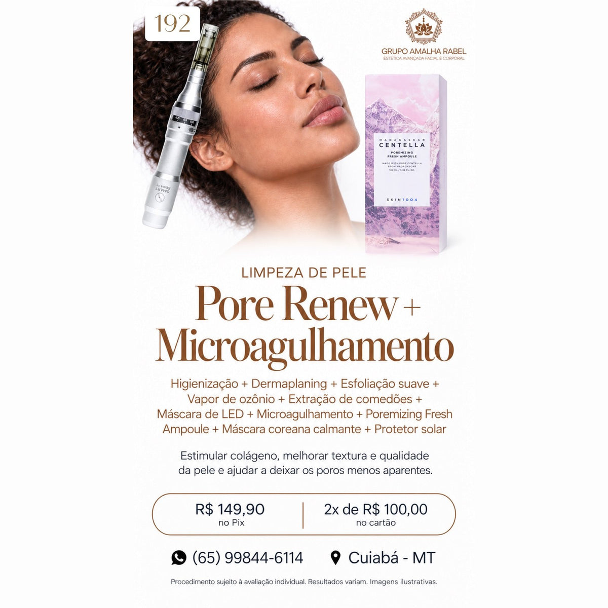 Limpeza de Pele Pore Renew + Microagulhamento