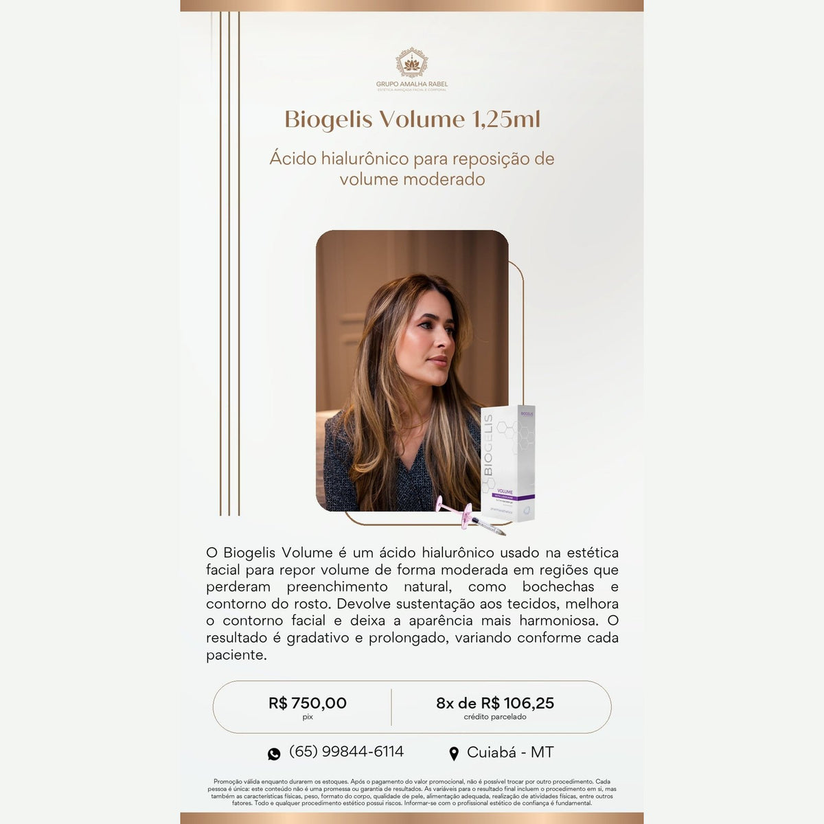 Biogelis Volume 1,25ml - Ácido hialurônico para reposição de volume moderado