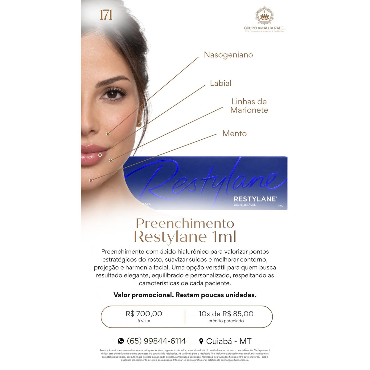 Preenchimento Restylane 1ml