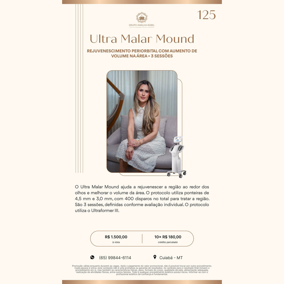 Ultra Malar Mound - REJUVENESCIMENTO PERIORBITAL COM AUMENTO DE VOLUME NA ÁREA • 3 SESSÕES (3 sessões)