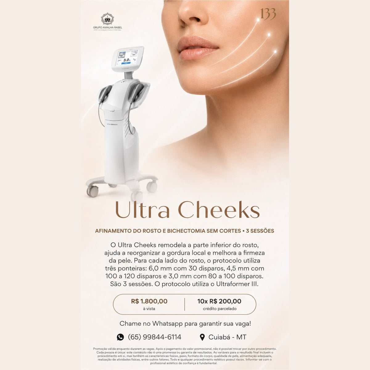 Ultra Cheeks - Afinamento do rosto e bichectomia sem cortes • 3 sessões