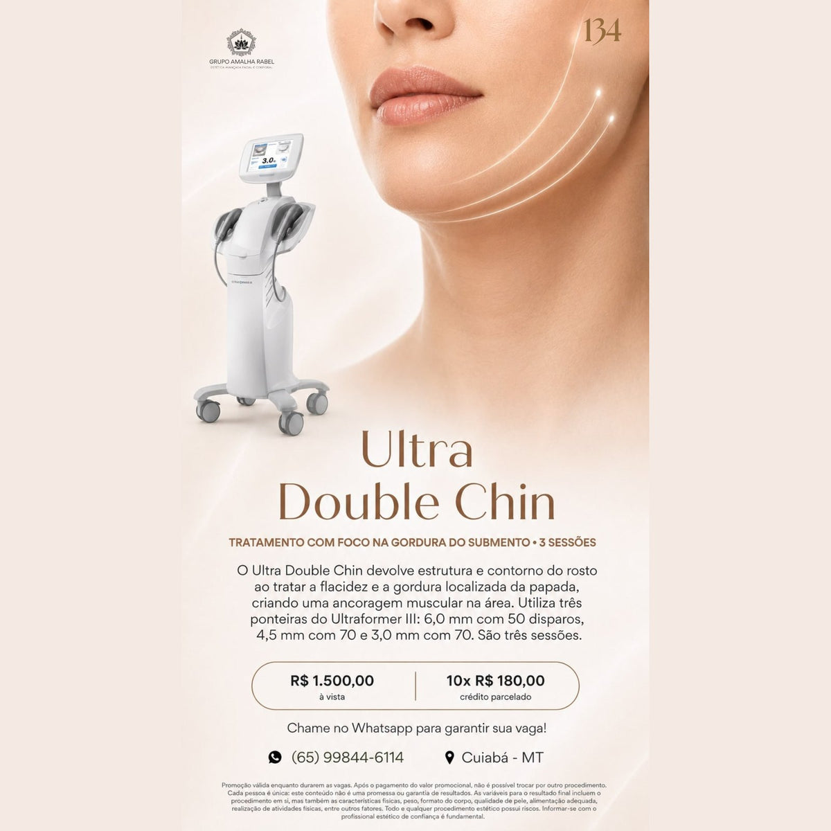 Ultra Double Chin - Tratamento com foco na gordura do submento • 3 sessões