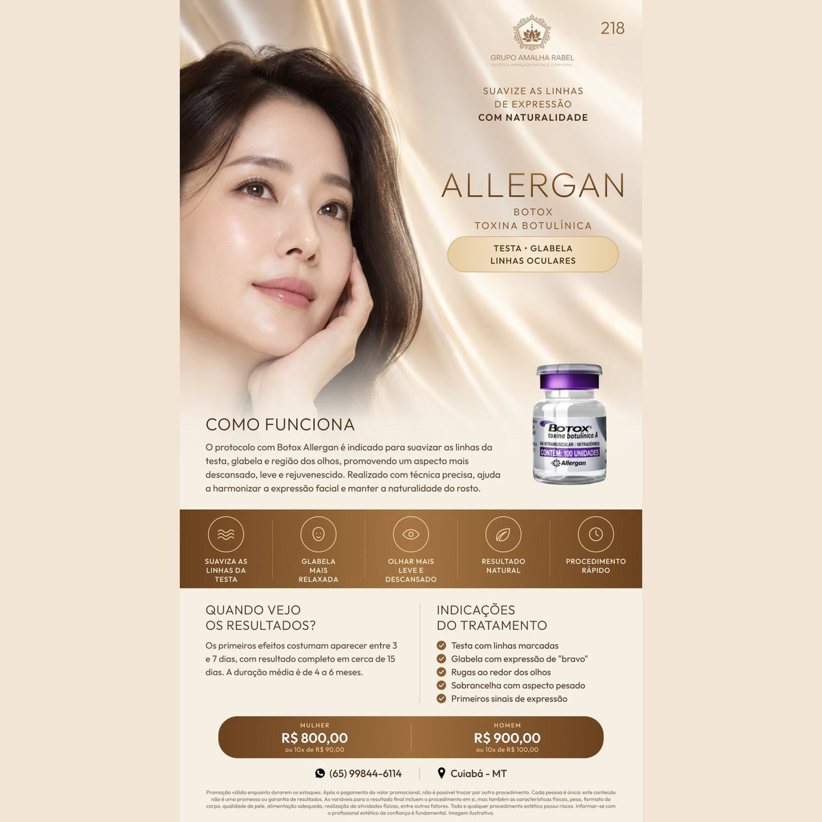 Allergan Testa Glabela Linhas Oculares (Mulher)