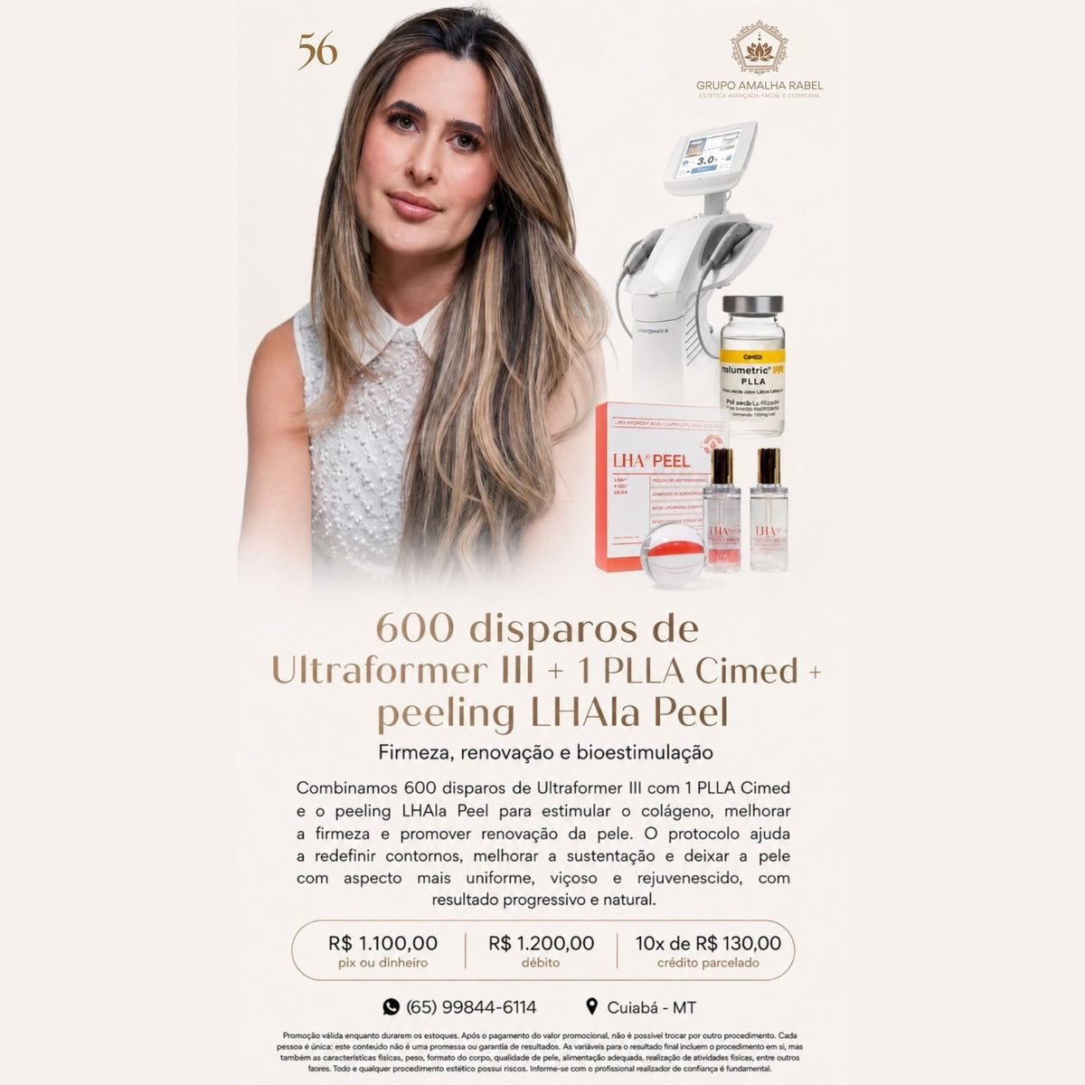 600 disparos de Ultraformer III + 1 PLLA Cimed + peeling LHAla Peel - Firmeza, renovação e bioestimulação