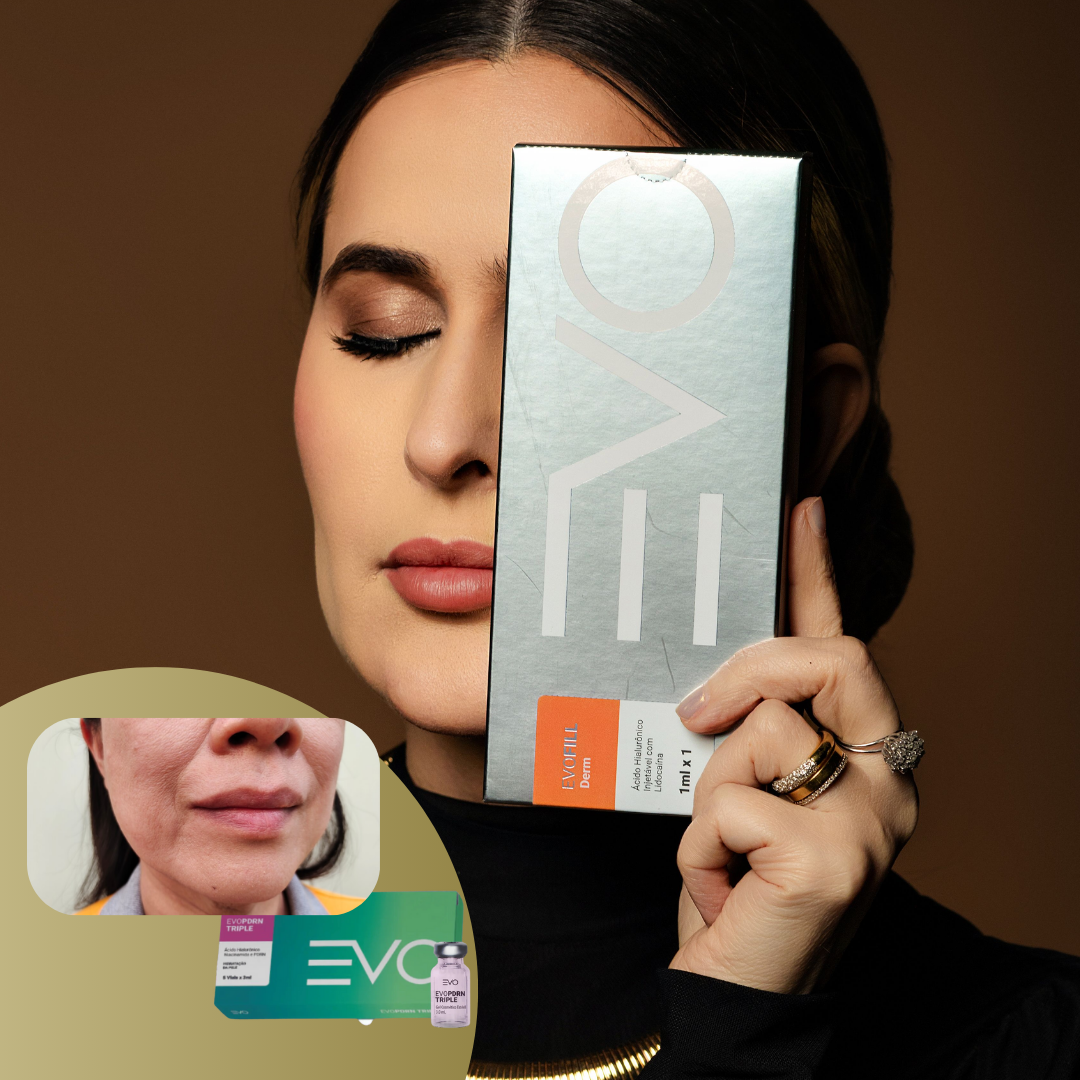 Tratamento para Bigode Chinês - Evo Fill Derm + Evo Triple