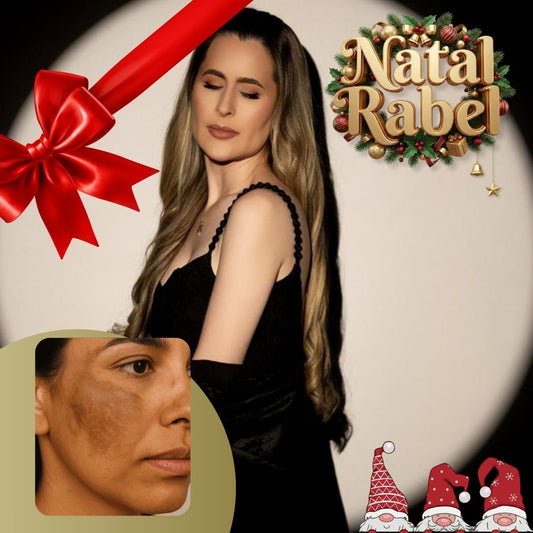 Tratamento para Melasma - 3 sessões de Laser Picossegundos + 3 sessões de PQQ Intramucular