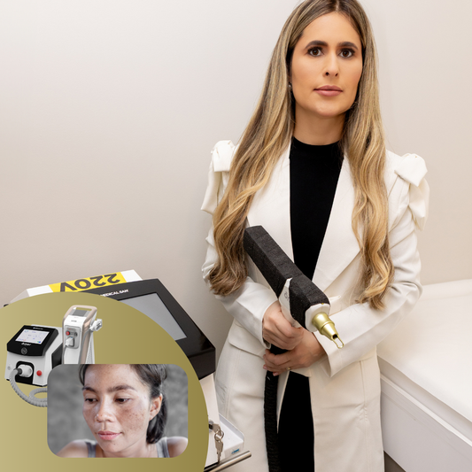 Melasma Vascular - Laser Ômer + Luz Pulsada