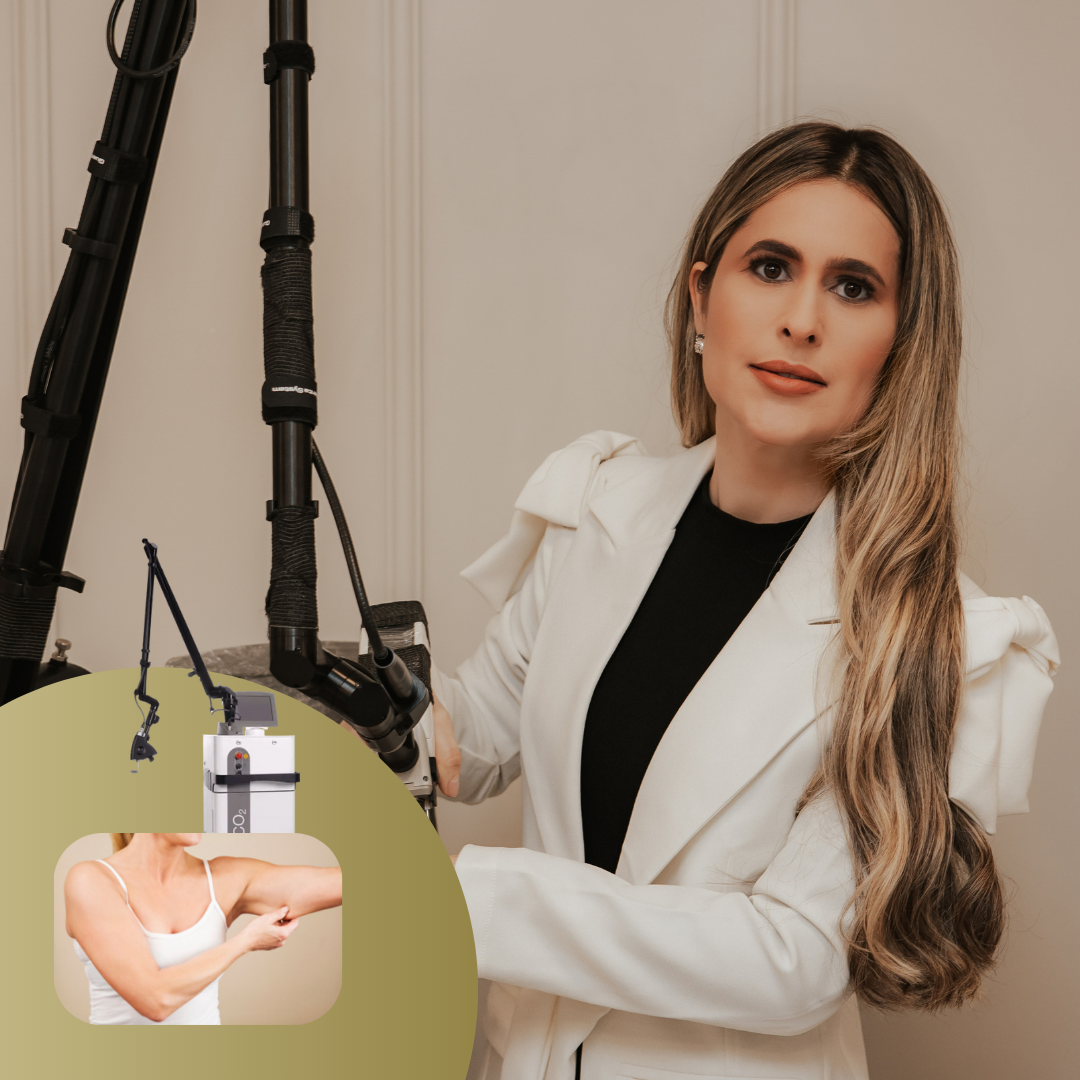 Laser CO2 para interno de braço (o tchauzinho) + PDRN Drug Delivery