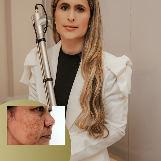 Combo melasma PQQ - Laser picossegundos + mescla de melasma + drug delivery Exossomos 1 ml +  Finalizado com PQQ (EV)